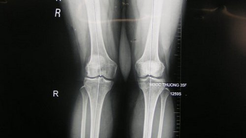 DoPFkMV7.jpg