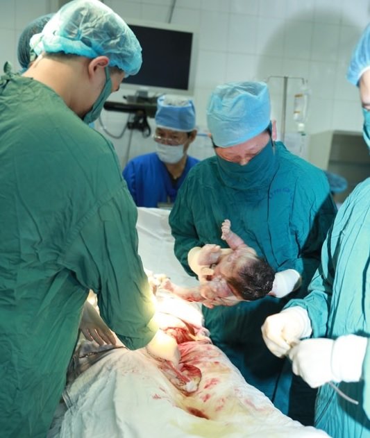Khoảnh khắc chào đời của bé gái được sinh con từ mang thai hộ đầu tiên ở Việt Nam - Ảnh: Trần Ngọc Kha