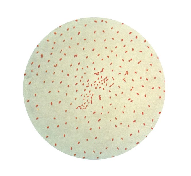 Trực khuẩn ho gà Bordetella pertussis - Ảnh: wikipedia