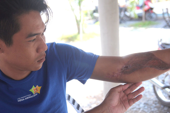 Theo anh Nguyễn Văn Ríl, từ ngày bị gãy tay sau khi bị mời lên công an xã đến nay, dù anh đã gửi đơn đến các cơ quan chức năng nhưng vẫn chưa được giải quyết. - Ảnh: MẬU TRƯỜNG