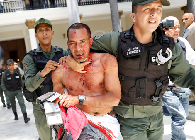 Một người ủng hộ chính phủ bị thương sau khi tham gia tấn công quốc hội Venezuela - Ảnh: Reuters