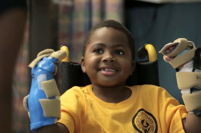 Em Zion Harvey ở Baltimore, Maryland với hai tay được ghép - Ảnh: AFP