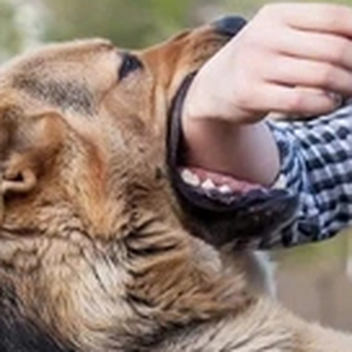 6 tháng đầu năm TP.HCM có 5 ca tử vong do dại, 100% không tiêm vắc xin