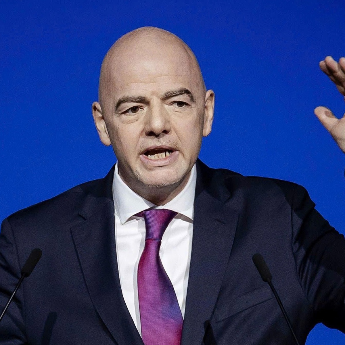 Dù đã xin lỗi, ông Infantino vẫn nhận tỉ lệ phản đối 86%