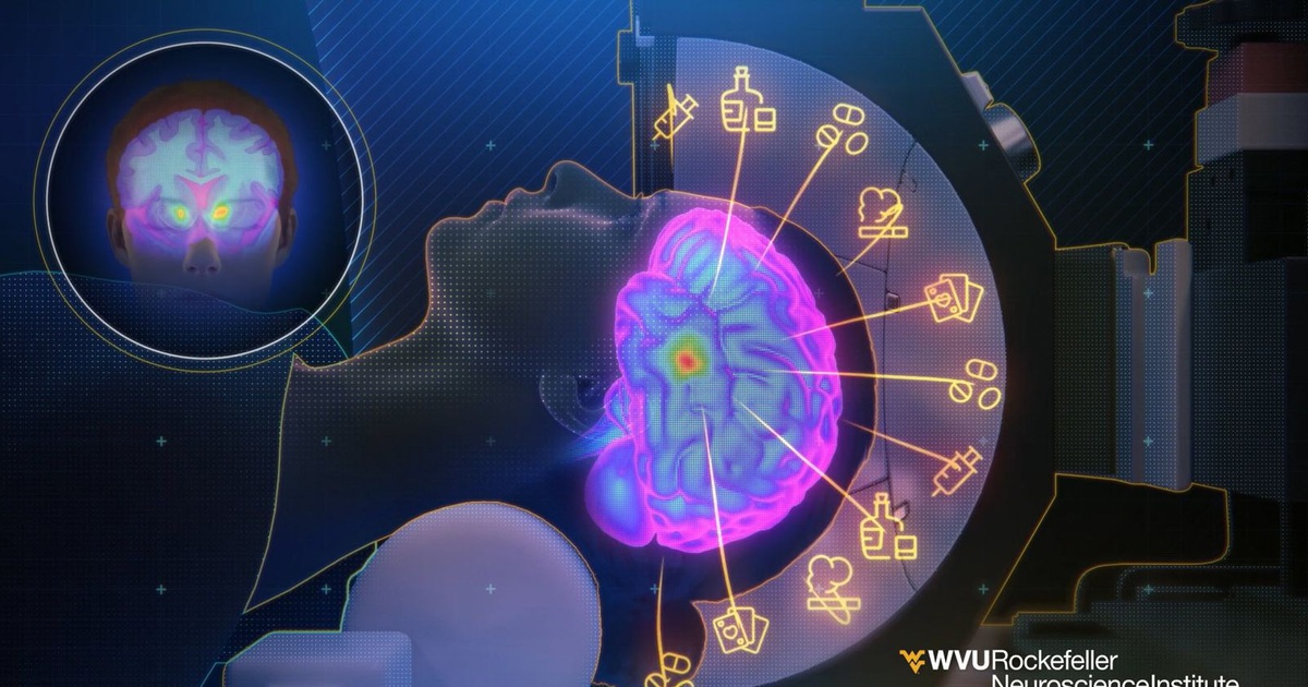 Đột phá trong điều trị chứng nghiện thuốc giảm đau opioid