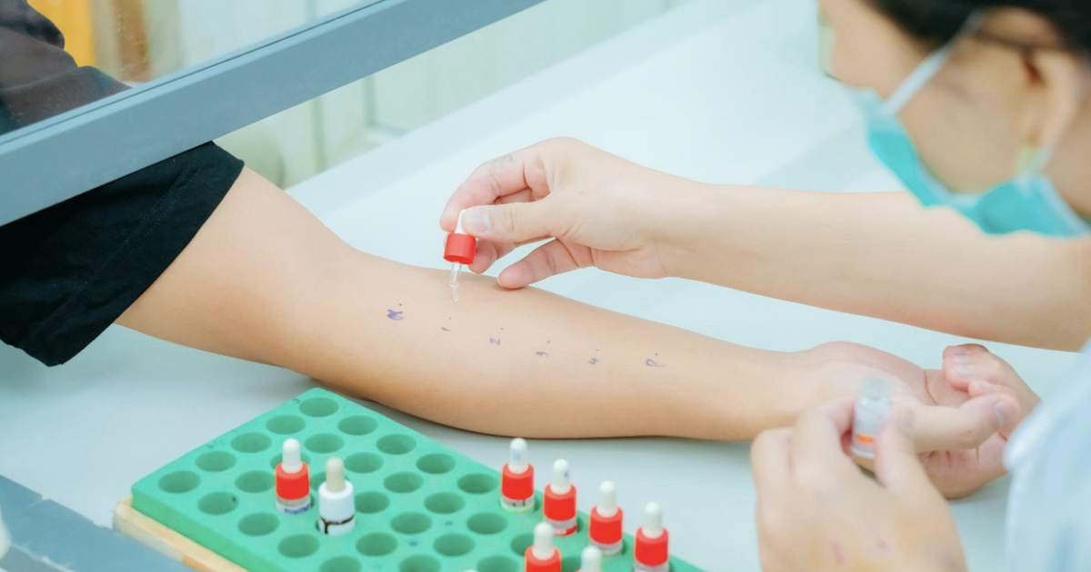 Dị ứng thức ăn và thuốc: Sai lầm từ thói quen tự chẩn đoán