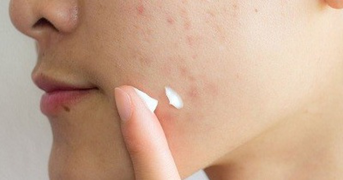 Thu hồi 5 sản phẩm mỹ phẩm của Công ty Kencare Việt Nam
