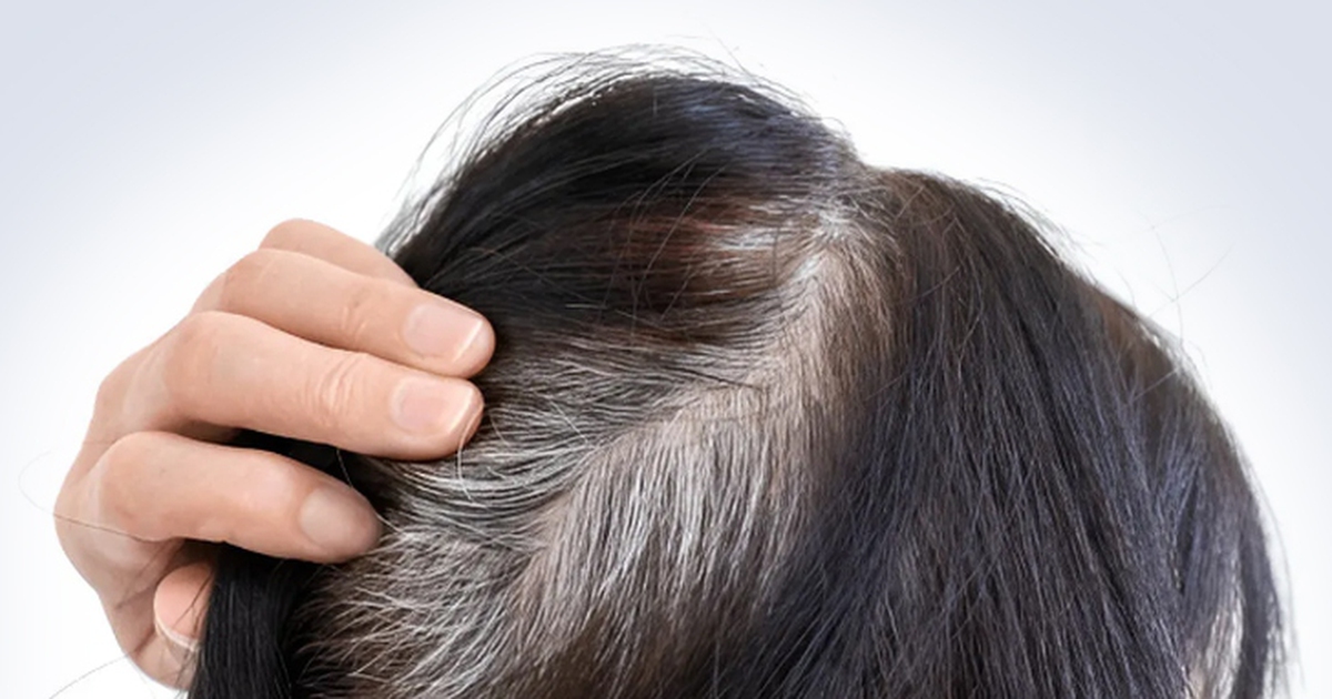 Mới chút xíu tuổi tóc đã bạc
