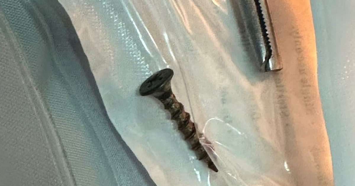 Đinh vít dài 4cm mắc trong đường thở bé gái 3 tháng tuổi
