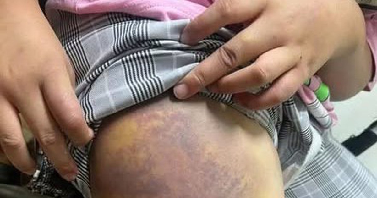 Đừng để trẻ gánh hậu quả từ thất bại của người lớn