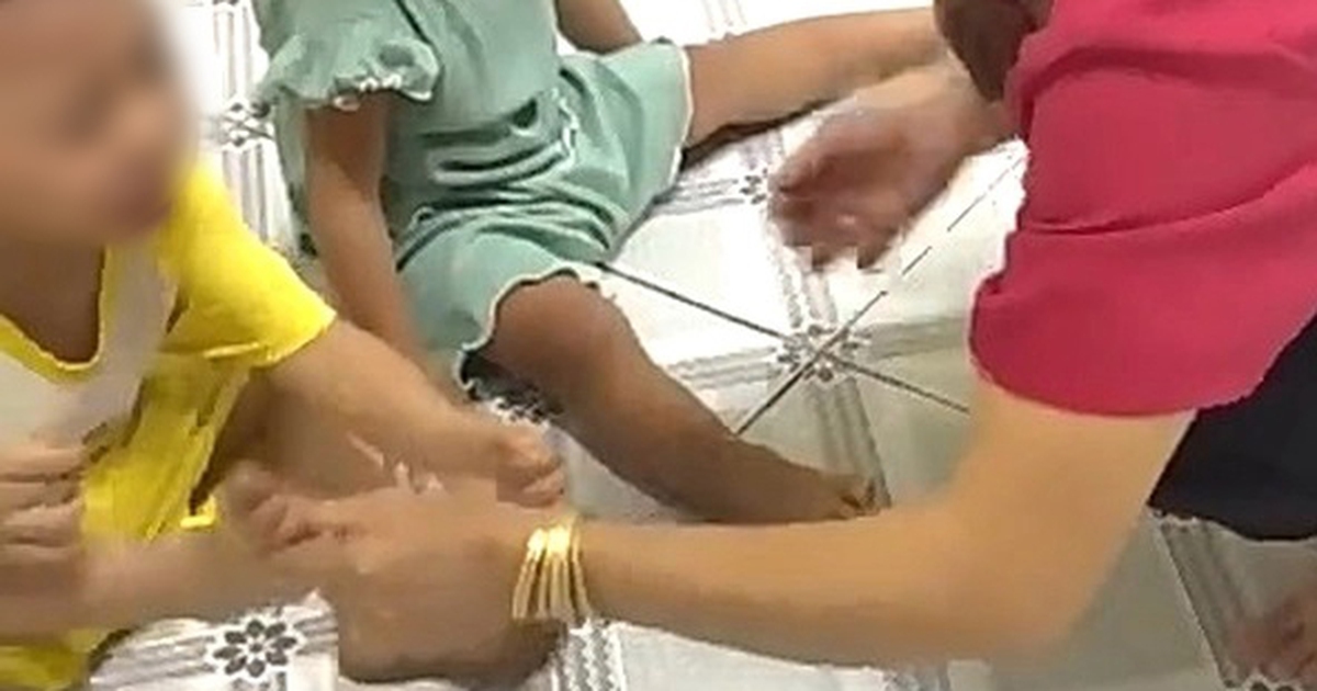 Bảo mẫu trường mầm non thừa nhận bắn dây thun vào chân trẻ