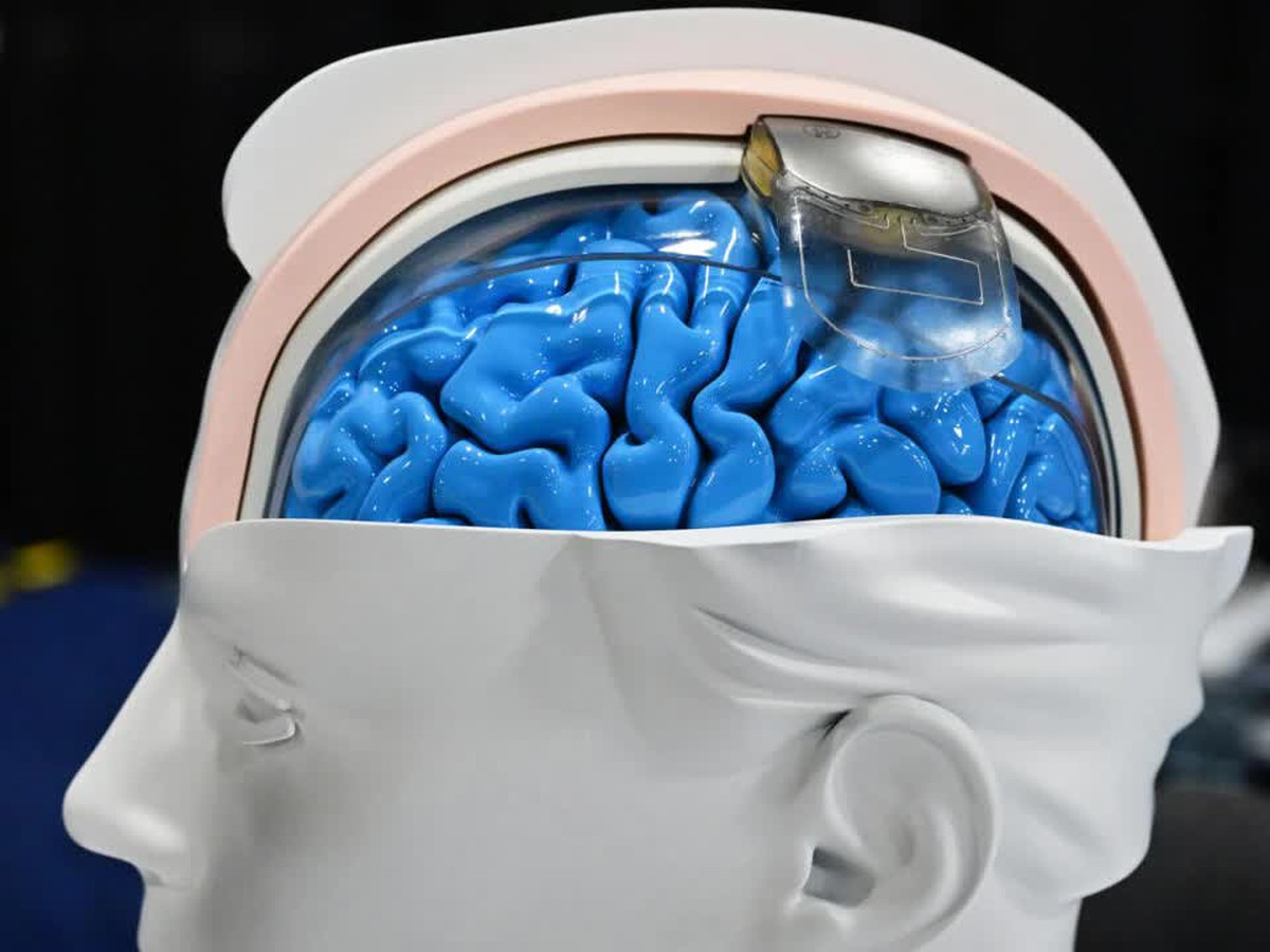 'We're already living in science fiction': The neurotech revolution