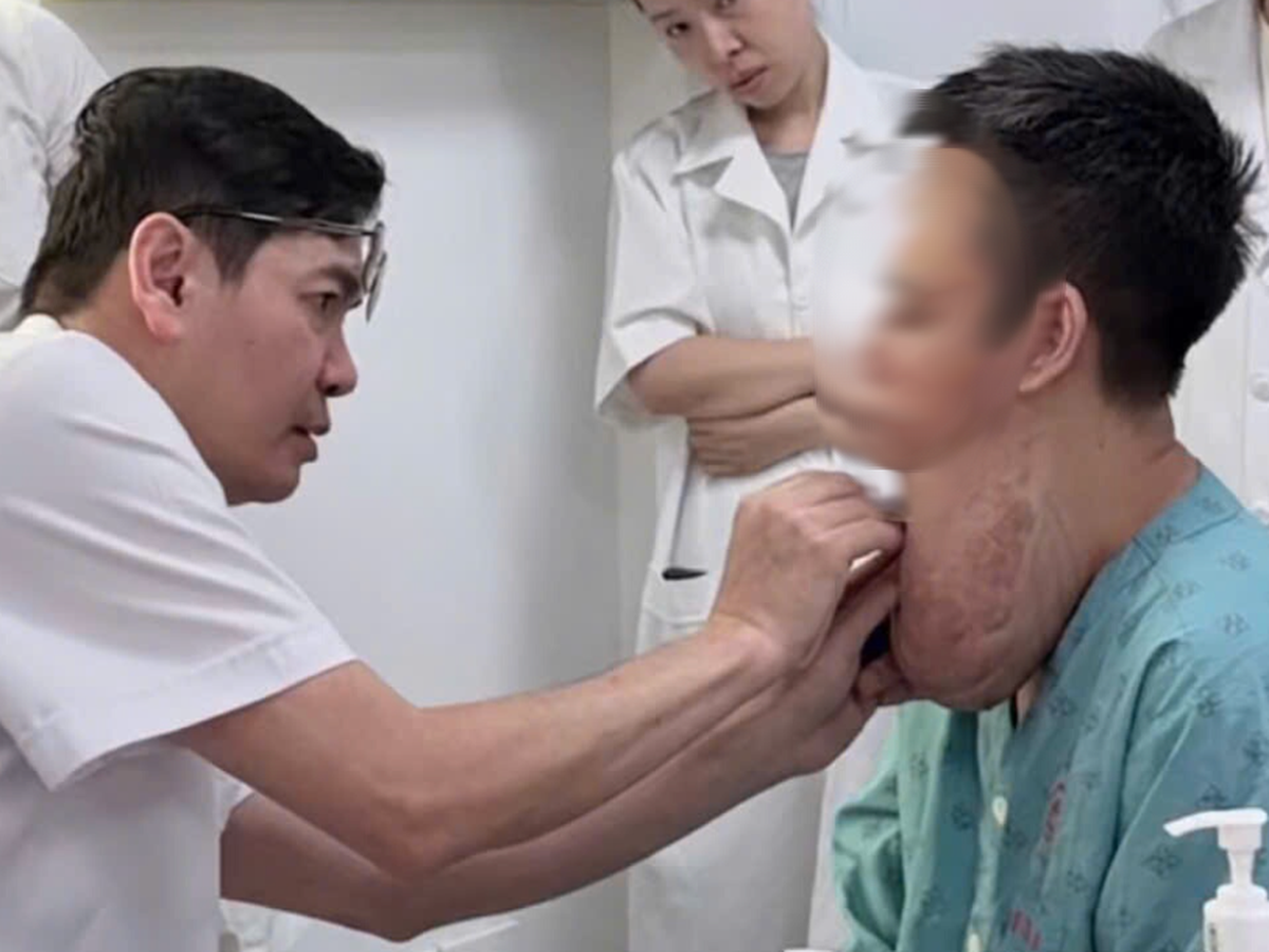 In Vietnam, doctors remove giant decade-old neck tumor from man