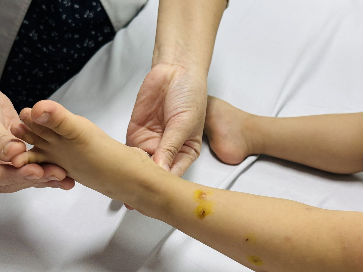 Ho Chi Minh City reports over 44,000 hand, foot and mouth disease cases, 60 samples test positive for EV71