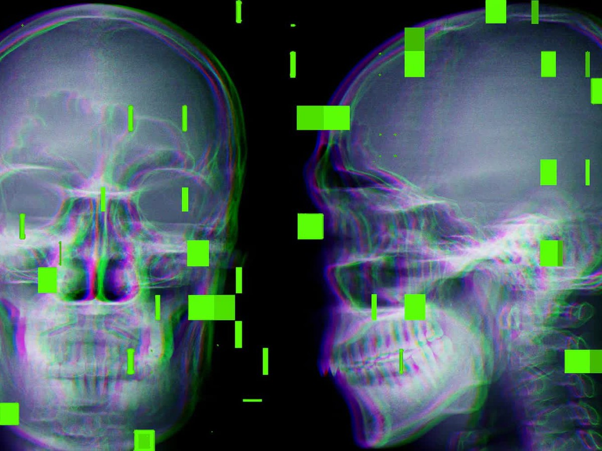 As AI enters the operating room, reports arise of botched surgeries and misidentified body parts