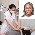 Tại sao nhiễm lạnh dễ dẫn đến liệt dây thần kinh số 7?