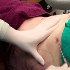 Thêm một phụ nữ tử vong do làm đẹp tại nhà