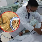 Vụ ngộ độc khi ăn cá ủ chua: Bác sĩ chỉ cách nhận biết thực phẩm chứa độc tố botulinum