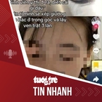 Tin tức tối 27-7: Trường ĐH Y Hà Nội sẽ kỷ luật nghiêm nữ sinh dọa lấy ven cho bệnh nhân trật 3 lần