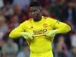 Cầu thủ Man United phải mặc đồ ‘nhái’ vì lý do khó đỡ