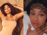 'Mỹ nhân nghiện dao kéo' Blac Chyna tự chê bai nhan sắc, nói mặt đầy filler của mình là điên rồ