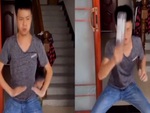 Chàng trai sưng trán khi luyện thiết đầu công