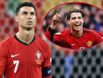 Cristiano Ronaldo dính nghi vấn phẫu thuật thẩm mỹ