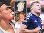 Rasmus Hojlund của Man Utd chi khủng để làm đẹp