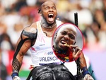Nhà vô địch Paralympic 2024 gây chú ý với bộ răng ‘ma cà rồng’