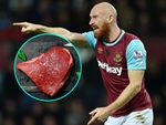 James Collins từng lót thịt bò trong giày thi đấu Ngoại hạng Anh