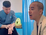Có phải lông nhiều thì sinh lý mạnh?