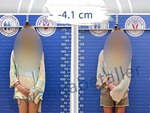 Cô gái 1m73 chi 20.000 USD cắt 4cm xương đùi để mình bớt cao