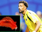 Fan cười ngất khi tên người hùng World Cup được đặt cho sên biển Vozinha