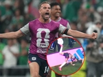 Sao tuyển Anh nhập viện vì chấn thương lúc... ăn mừng ở World Cup