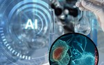 AI mới của Canada giúp phát hiện sớm dấu hiệu ung thư khó thấy