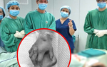 Nối thành công bàn tay cho sản phụ sau gần hai tháng ‘nuôi chi’ ở cẳng chân