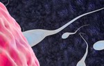 Chấn động y học: Người hiến tinh trùng mang gene ung thư, sinh ra 67 trẻ, 10 em bị bệnh