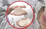 Cô gái Trung Quốc bị đâm hơn 20 nhát, thoát chết nhờ túi nâng ngực
