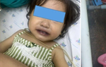 Bé 16 tháng tuổi tím tái sau bữa ăn vì gia đình dùng nước giếng nấu canh