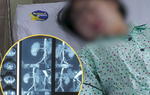 Mẹ hiến thận cứu con gái và cảnh báo của bác sĩ về thói quen gây hại cho thận