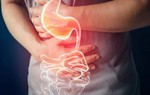 Viêm loét dạ dày tá tràng ăn uống như thế nào để nhanh khỏi bệnh?