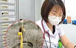 Nhiều người nhiễm sán dây, gặp biến chứng nặng do thói quen ăn đồ sống