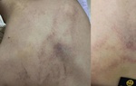Lời của người cha tố cô giáo mầm non đánh, kéo lê, ném bé gái 4 tuổi vào tường