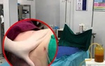 Lời khai của bác sĩ 'dỏm' thực hiện hàng trăm ca hút mỡ chui tại TP.HCM