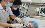 Cụ bà 80 tuổi hôn mê vì uống nhầm chai methadone của cháu trai