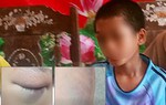 Người cô cầu cứu khi cháu 12 tuổi nghi bị cha và mẹ kế bạo hành