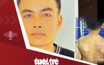 Tin tức tối 8-5: Khởi tố người cha đánh con ruột gây thương tích 36%