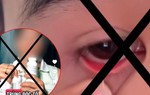 Chuyên gia nói gì về các quảng cáo thải độc, lôi 'ký sinh trùng' ra từ mắt?