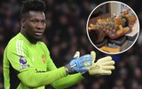 Andre Onana gây rợn người khi 'nâng tầm' liệu pháp giác hơi