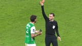 Cầu thủ ở Pháp gãy tay vì đấm tường sau khi nhận thẻ đỏ